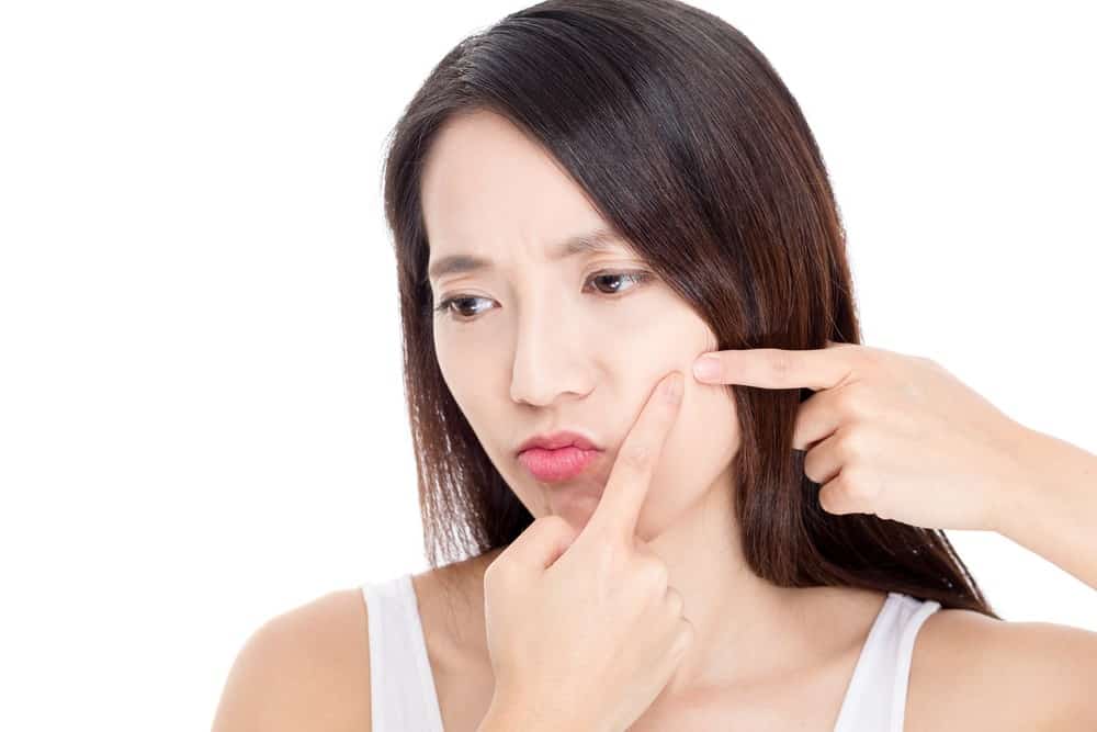 get rid of acne cheeks